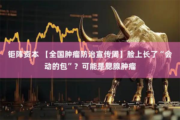 钜阵资本 【全国肿瘤防治宣传周】脸上长了“会动的包”?可能是腮腺肿瘤